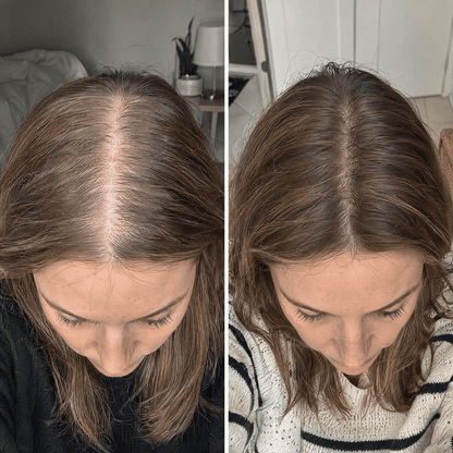 Rosemary & Rice Water Hair Spray
