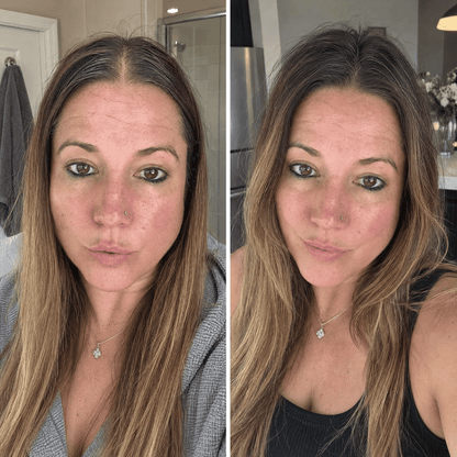 Rosemary & Rice Water Hair Spray